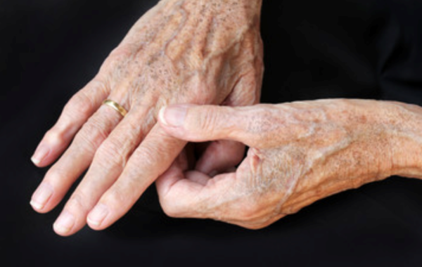 Ringiovanimento delle mani: i rimedi per mani più giovani